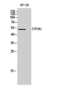 CYP2R1 rabbit pAb 50µL/100µL