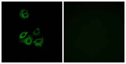 Chemokine Receptor D6 rabbit pAb