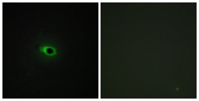 COL12A1 rabbit pAb 50µL/100µL