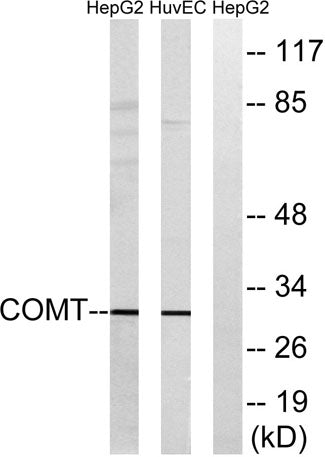 COMT rabbit pAb 50µL/100µL