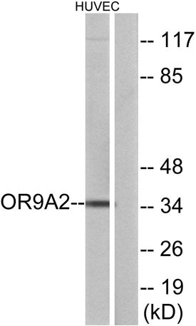 Olfactory receptor 9A2 rabbit pAb 50µL/100µL