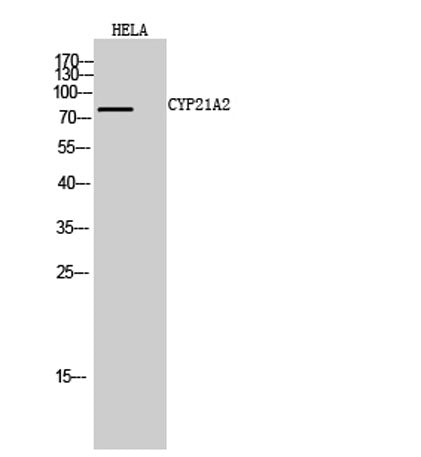 CYP21A2 rabbit pAb 50µL/100µL