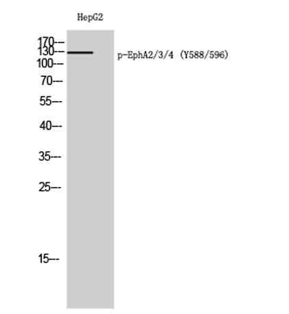 EphA2/3/4 (phospho Tyr588/596) rabbit pAb
