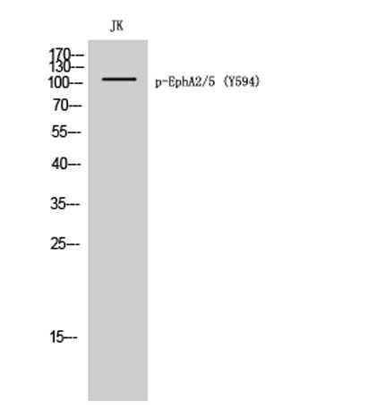 EphA2/5 (phospho Tyr594) rabbit pAb