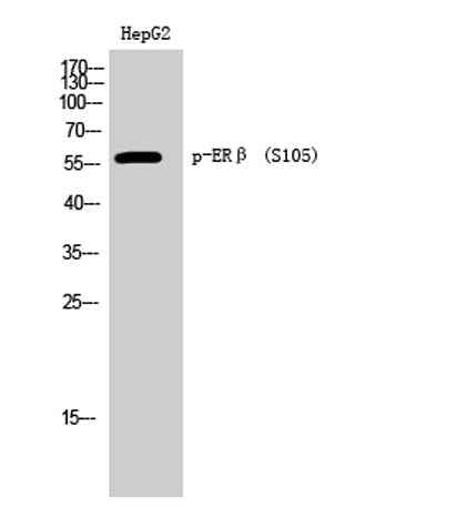 ERβ (phospho Ser105) rabbit pAb
