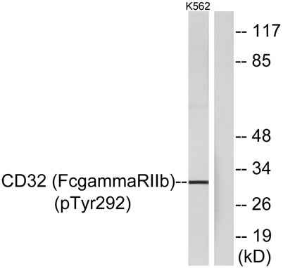 CD32 (phospho Tyr292) rabbit pAb