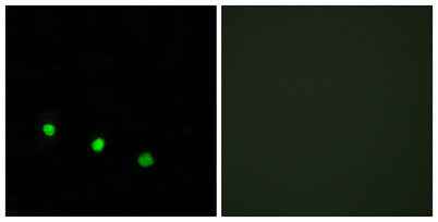 Fos B (phospho Ser27) rabbit pAb