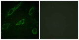 c-Abl (phospho Tyr245) rabbit pAb