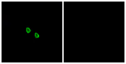 MRGX1 rabbit pAb 50µL/100µL