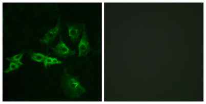 GnRH-R rabbit pAb