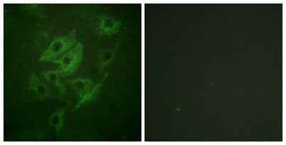 NMDAε1/2 rabbit pAb