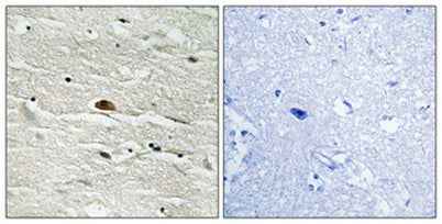 HMG-14 (phospho Ser21) rabbit pAb