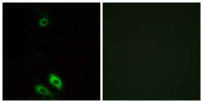 AKR1CL1 rabbit pAb