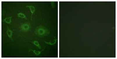 IFN-α/βRα rabbit pAb