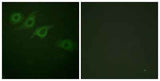 IFN-γRα rabbit pAb