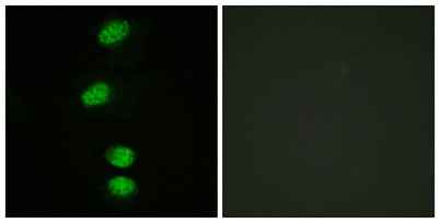 AR (phospho Ser94) rabbit pAb