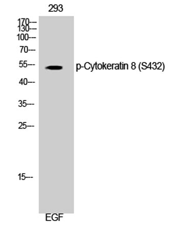 Cytokeratin 8 (phospho Ser432) rabbit pAb 50µL/100µL