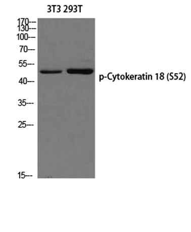 Cytokeratin 18 (phospho Ser52) rabbit pAb