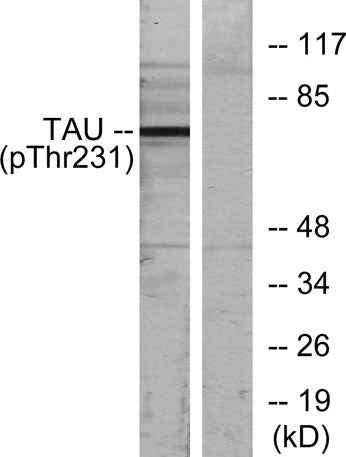 Tau (phospho Thr231) rabbit pAb
