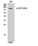 CD71/TfR (phospho Ser24) rabbit pAb 50µL/100µL