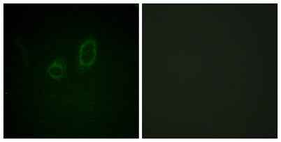 Moesin/Ezrin/Radixin (phospho Thr558) rabbit pAb