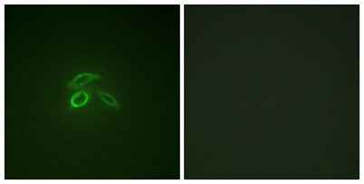 Mucin 1 (phospho Tyr1229) rabbit pAb