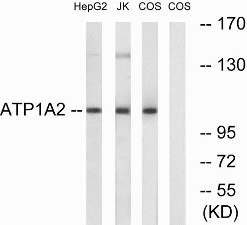 Na+/K+-ATPase α2 rabbit pAb 50µL/100µL