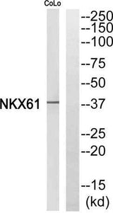 Nkx-6.1 rabbit pAb