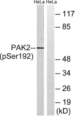 PAKγ (phospho Ser192) rabbit pAb