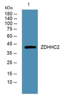 ZDHHC2 rabbit pAb