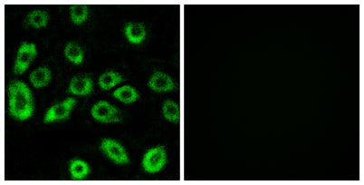 ATP5D rabbit pAb 50µL/100µL