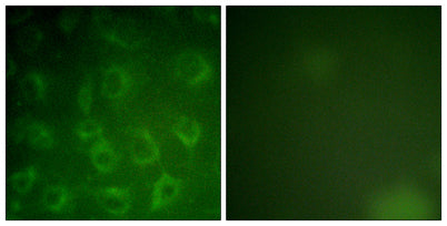 PDGFR-β rabbit pAb 50µL/100µL