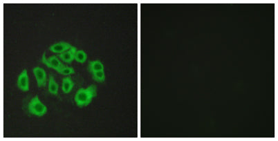 Endomucin rabbit pAb 50µL/100µL