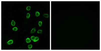 ATP5G3 rabbit pAb