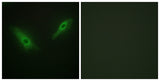 PHKA1/2 rabbit pAb 50µL/100µL