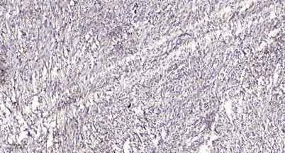 PKD2 (phospho Ser812) rabbit pAb
