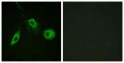 PLC γ2 (phospho Tyr1217) rabbit pAb