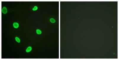 Acetyl Histone H2B (K12) rabbit pAb