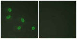 TRAP220 (phospho Thr1457) rabbit pAb