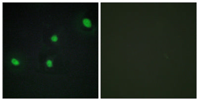 CdcA4 rabbit pAb 50µL/100µL