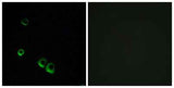 AVP Receptor V2 rabbit pAb