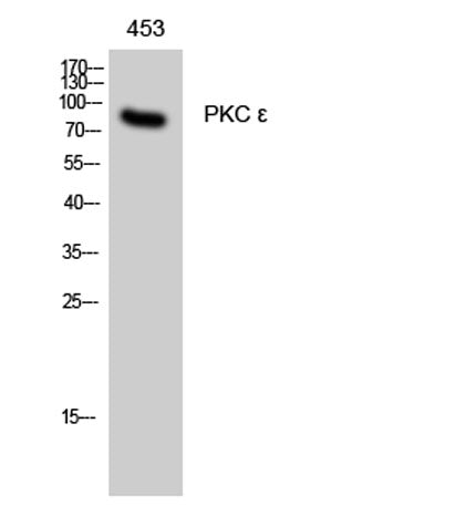 PKC ε rabbit pAb 50µL/100µL