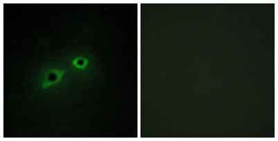Enterokinase HC rabbit pAb