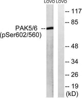 PAK5/6 (phospho Ser602/S560) rabbit pAb