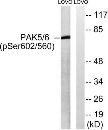 PAK5/6 (phospho Ser602/S560) rabbit pAb