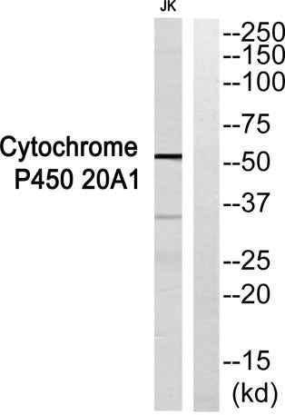 CYP20A1 rabbit pAb