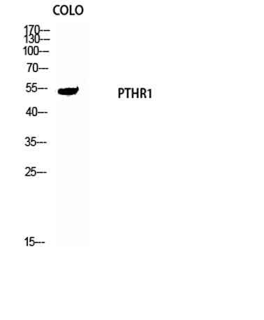 PTH/PTHrP-R rabbit pAb