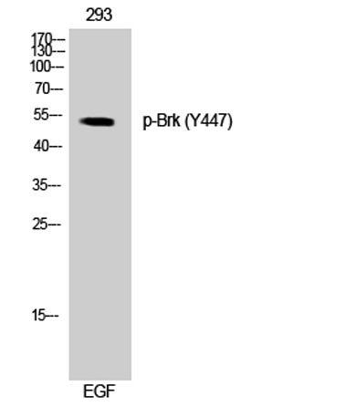 Brk (phospho Tyr447) rabbit pAb 50µL/100µL