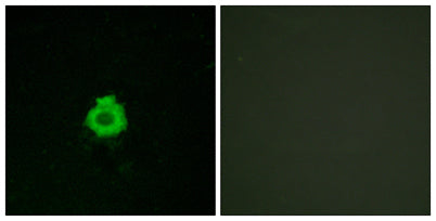 BAI-2 rabbit pAb 50µL/100µL
