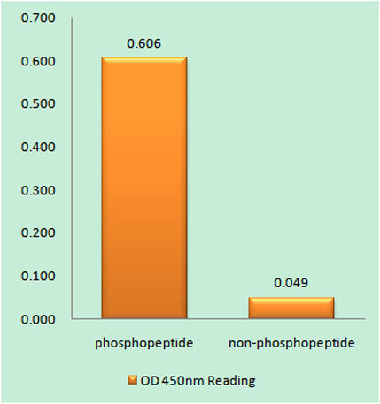 Rb (phospho Ser811) rabbit pAb 50µL/100µL